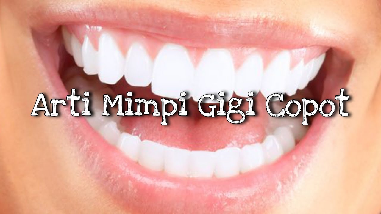 Arti mimpi gigi copot